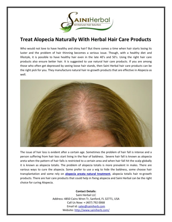 Treat Alopecia Naturally With Herbal Hair Care Products