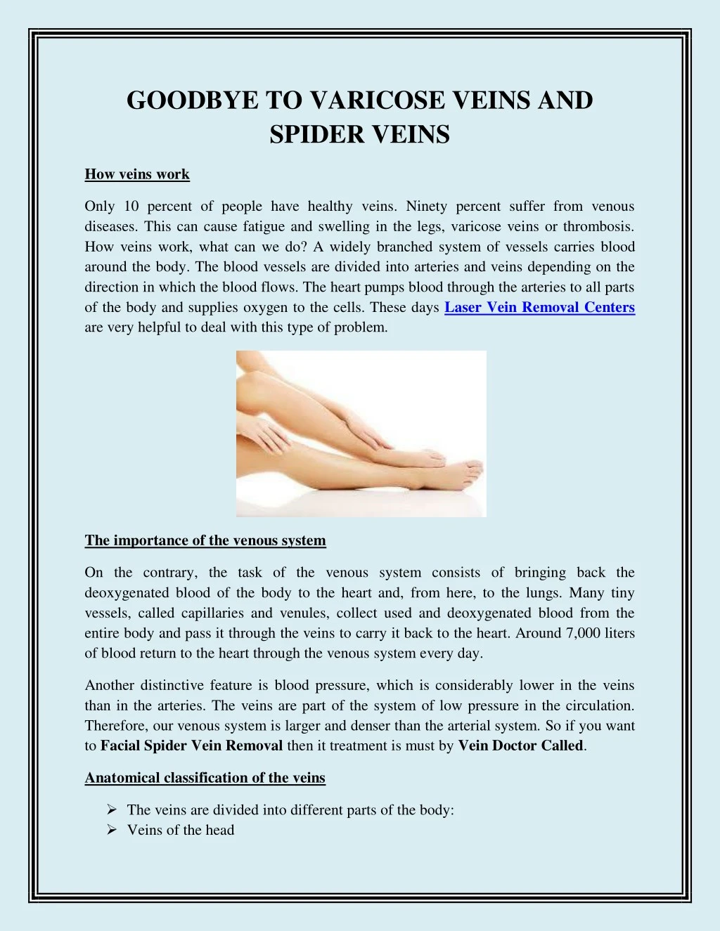 goodbye to varicose veins and spider veins