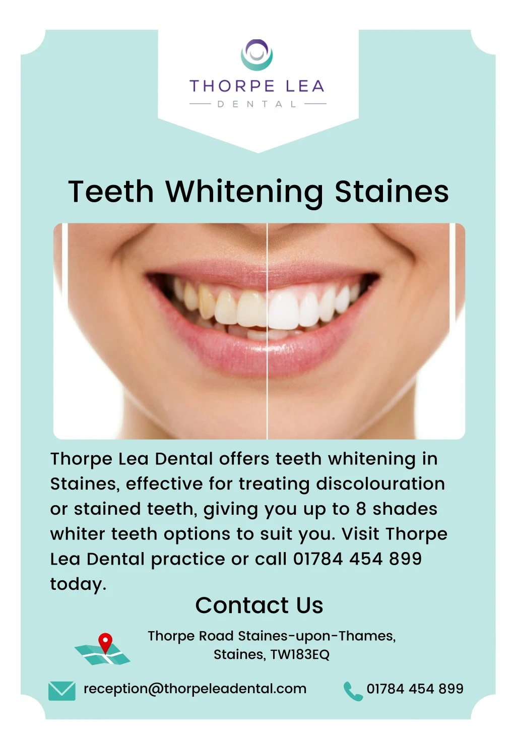 teeth whitening staines