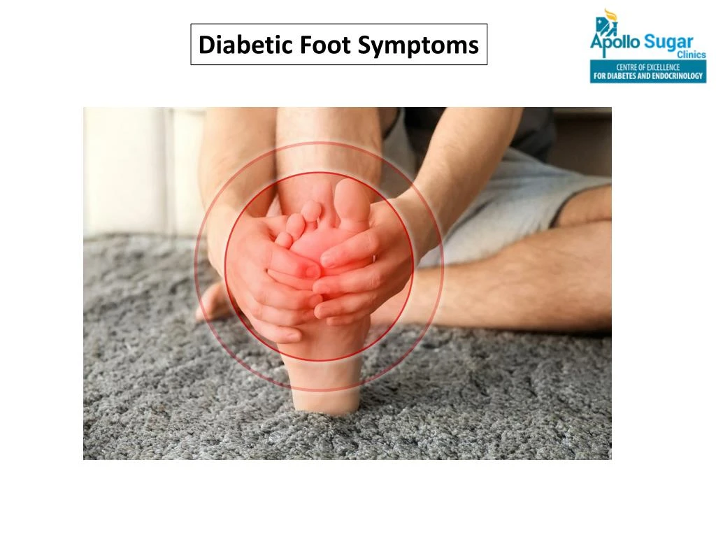 diabetic foot symptoms