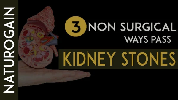 3 Non Surgical Ways to Pass Kidney Stones Naturally at Home