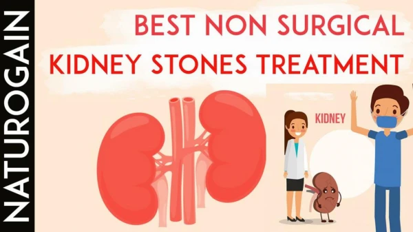 Best Non Surgical Treatment for Kidney Stones [WITHOUT] Pain