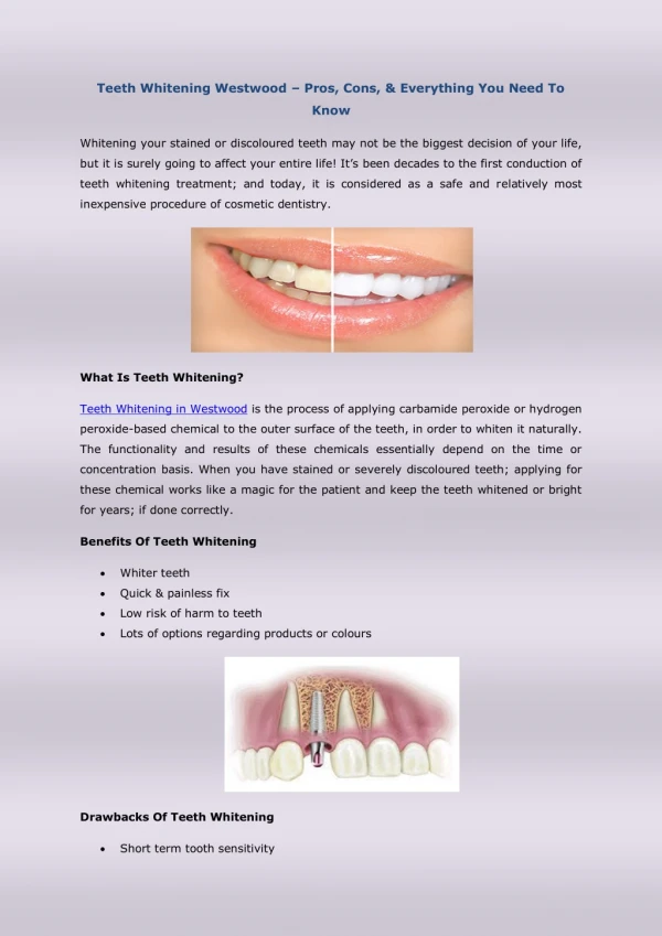 Teeth Whitening Westwood – Pros, Cons, & Everything You Need To Know