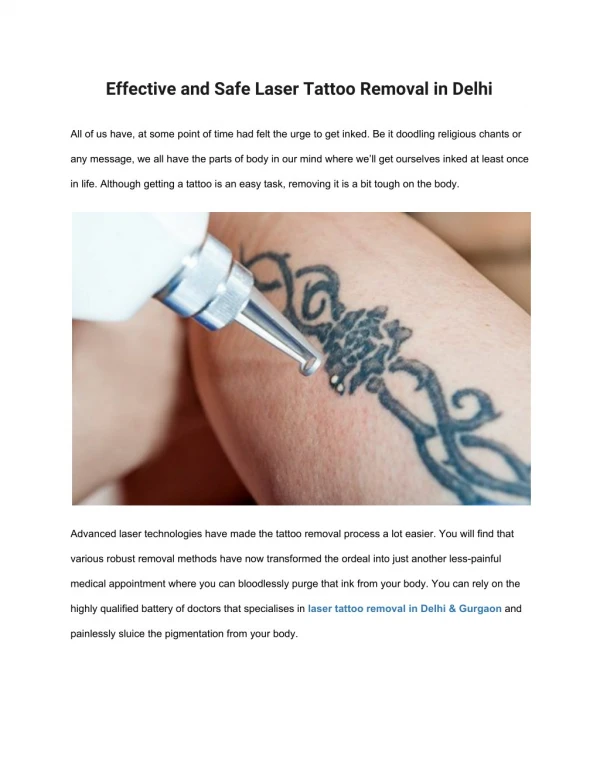 Effective and Safe Laser Tattoo Removal in Delhi