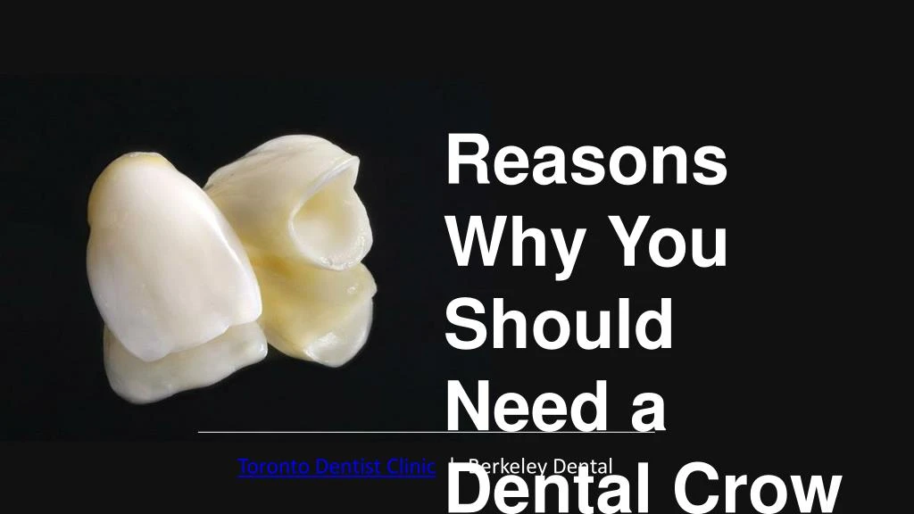 reasons why you should need a dental crown