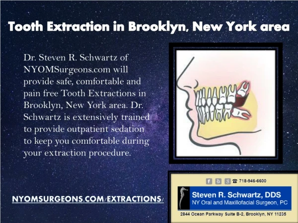 Tooth Extraction in Brooklyn, New York area - NYOMSurgeons.com
