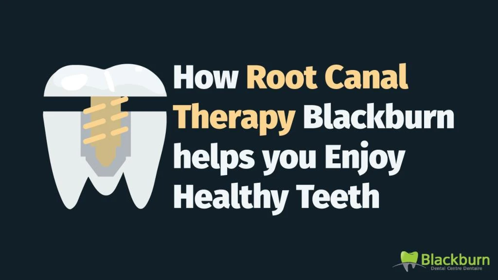 how root canal therapy blackburn helps you enjoy healthy teeth