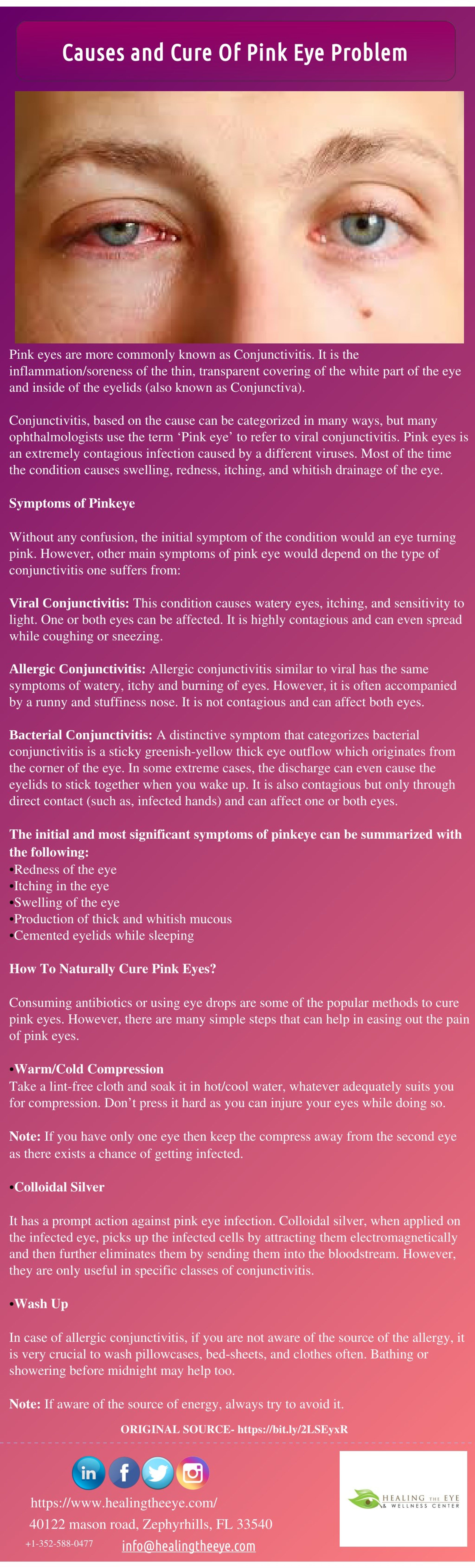 PPT - Causes and Cure Of Pink Eye Problem PowerPoint Presentation, free ...