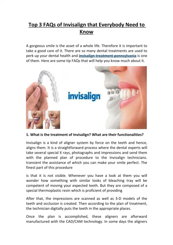 Top 3 FAQs of Invisalign that Everybody Need to Know