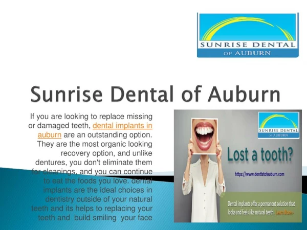 Dental Implants in Auburn | Best Replacing Missing Tooth Solution
