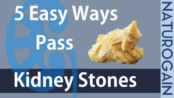5 Easy Ways to Pass Kidney Stones FAST without Pain at Home