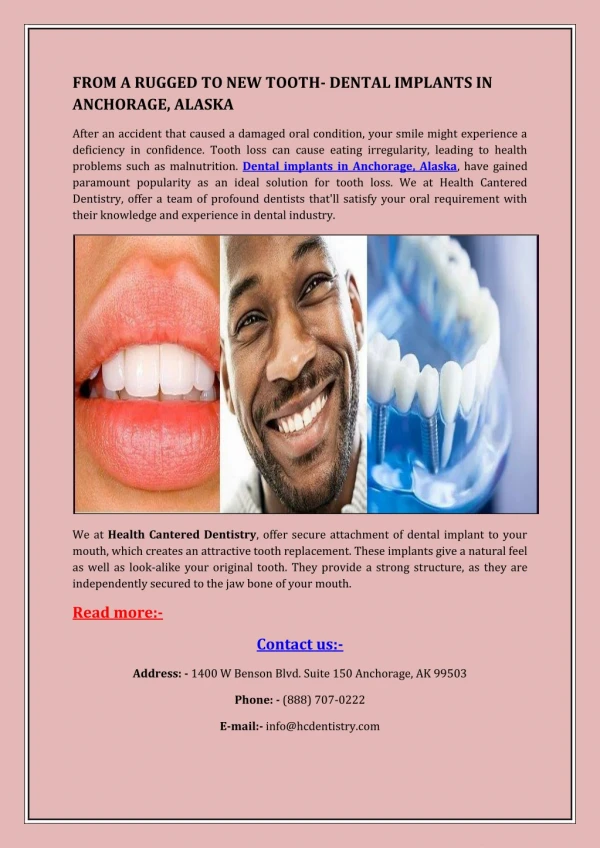 DENTAL IMPLANTS SERVICES IN ANCHORAGE