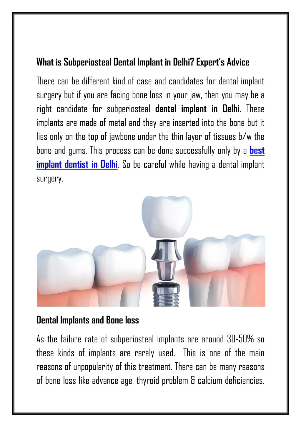 what is subperiosteal dental implant in delhi