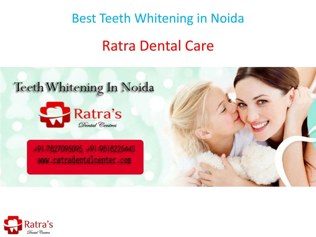 best teeth whitening in noida