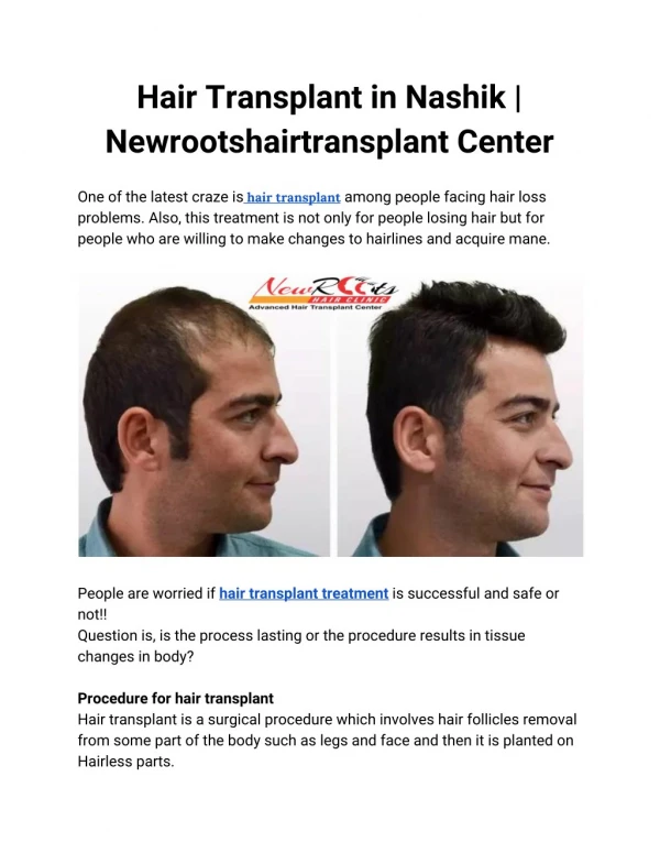 Hair Transplant in Nashik | Newrootshairtransplant Center