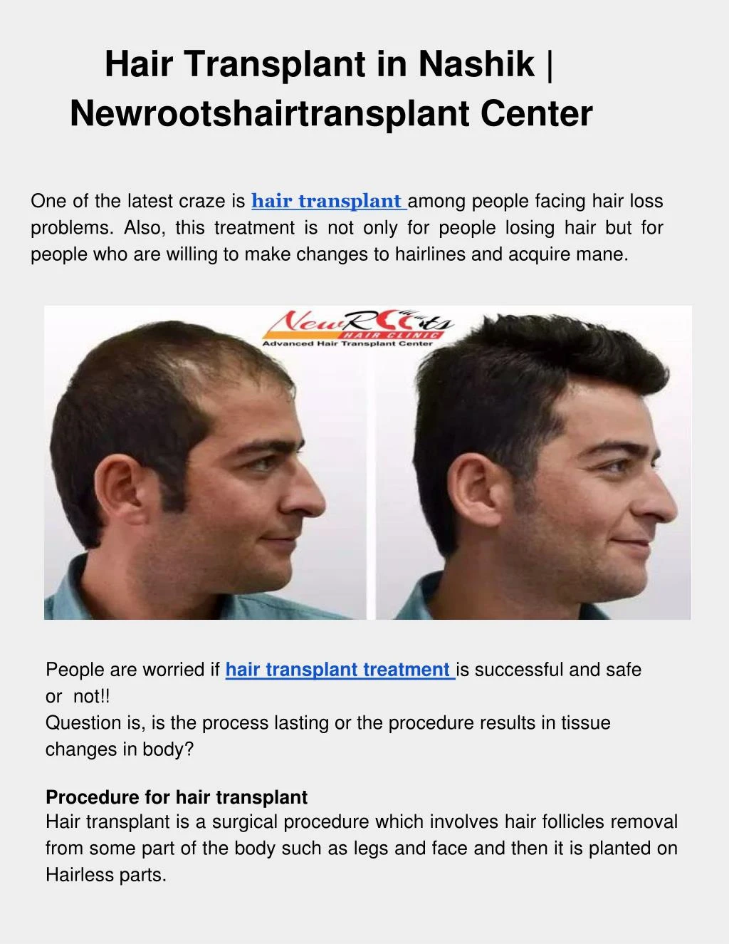 hair transplant in nashik newrootshairtransplant center