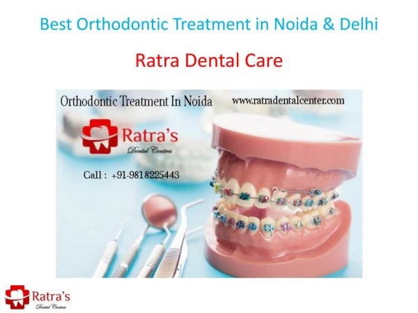 Best Orthodontic Treatment in Noida & Delhi