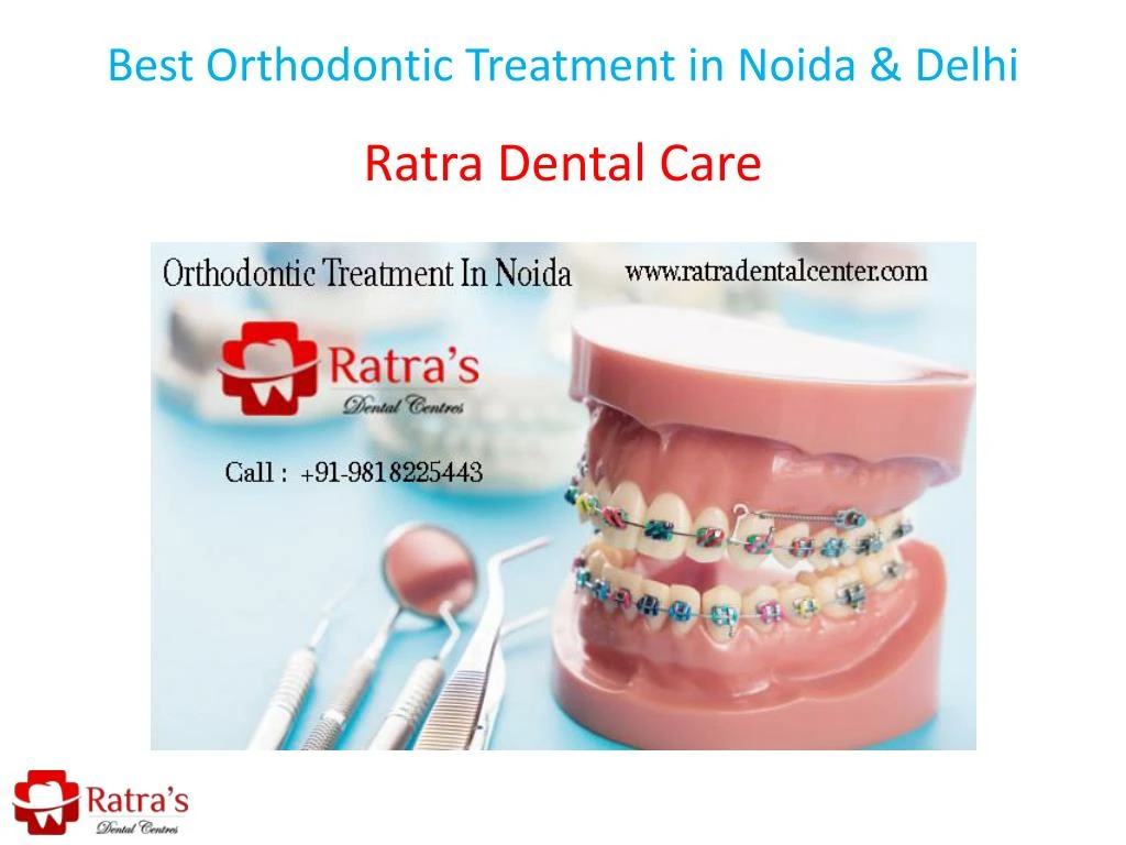 best orthodontic treatment in noida delhi