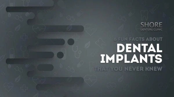 6 Fun Facts About Dental Implants That You Never Knew