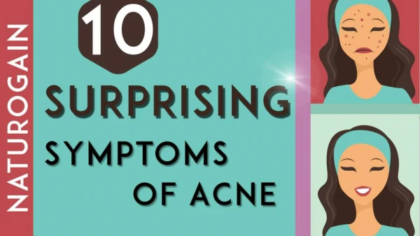 10 Symptoms of Acne Best Face Pack to Make Skin Glowing, Fair Naturally