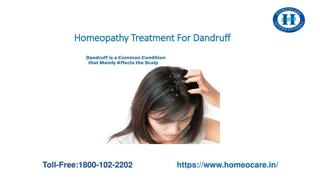 homeopathy treatment for dandruff