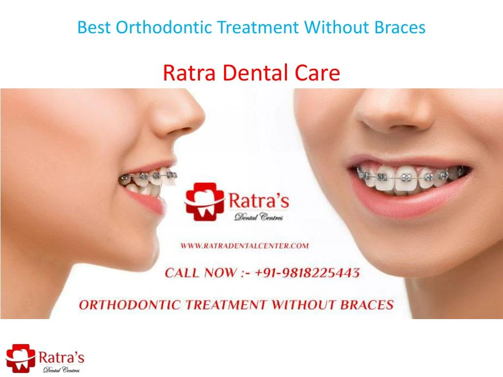 best orthodontic treatment without braces