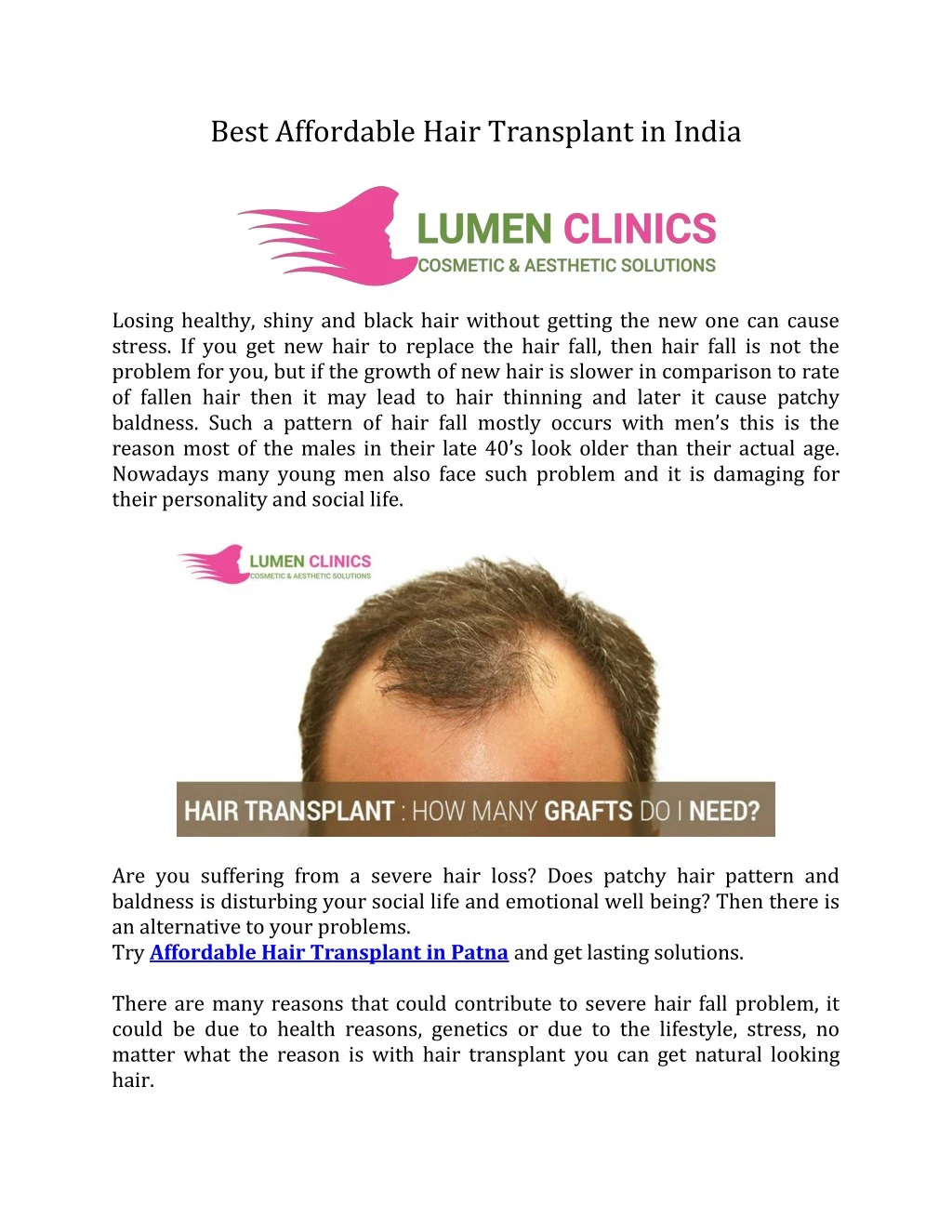best affordable hair transplant in india