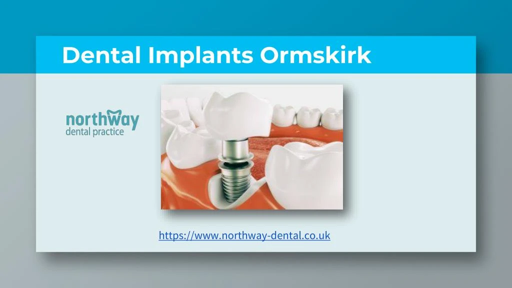 dental implants ormskirk