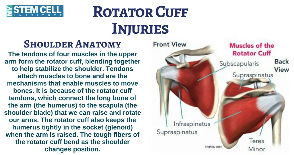 rotator cuff injuries