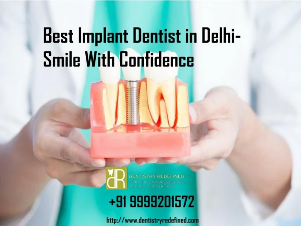 Best Implant Dentist in Delhi | Dental implant in Delhi