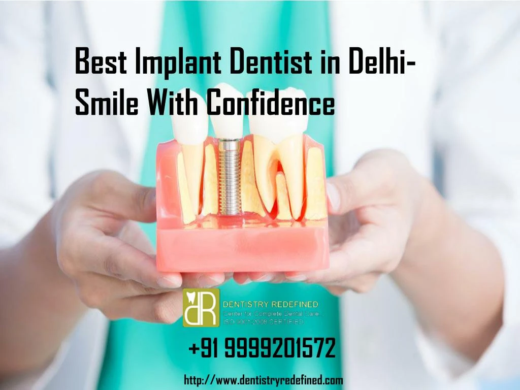 best implant dentist in delhi smile with