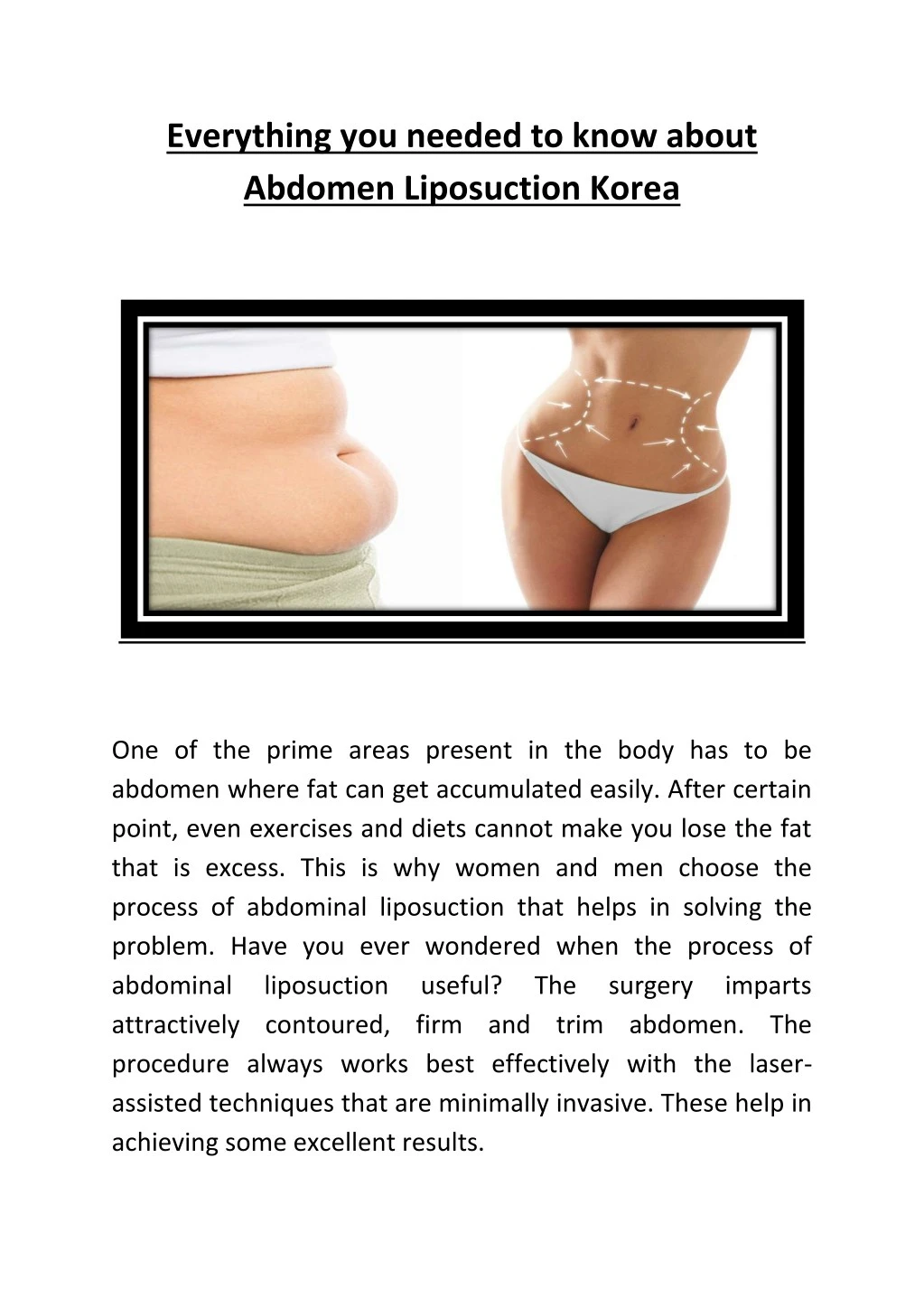 everything you needed to know about abdomen
