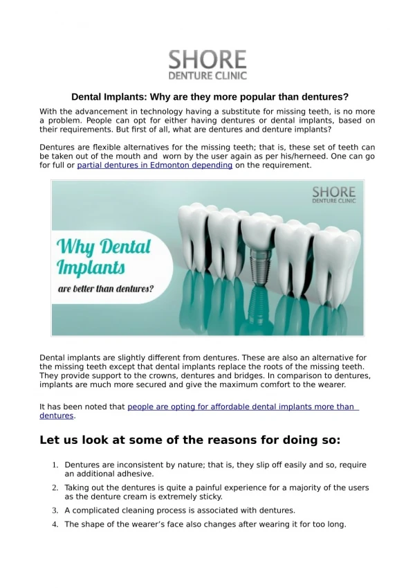 Dental Implants: Why are they more popular than dentures?