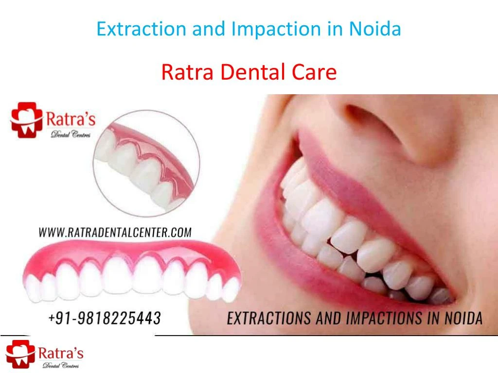 extraction and impaction in noida
