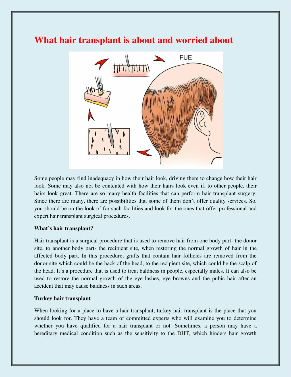what hair transplant is about and worried about