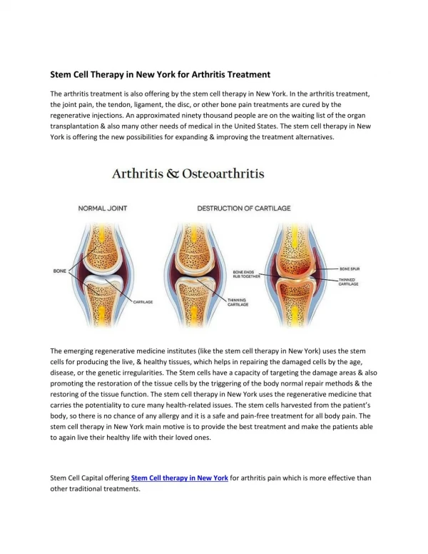 Stem Cell Therapy in New York for Arthritis Treatment