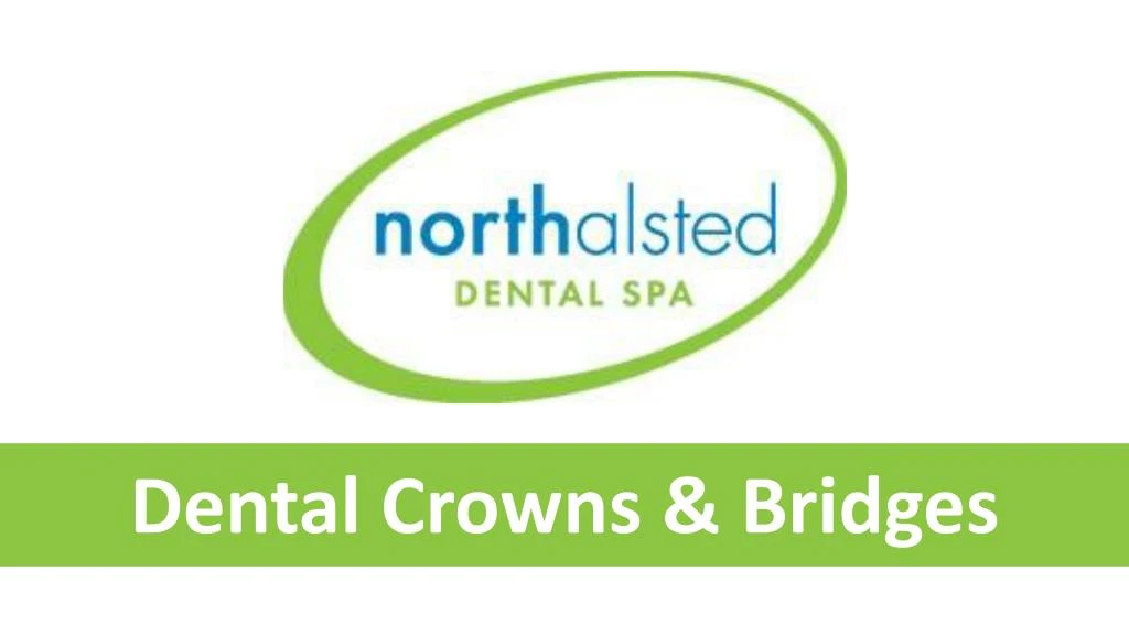 dental crowns bridges