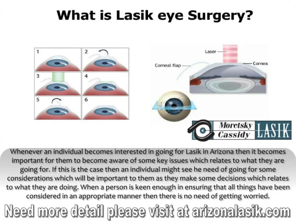 What is Lasik eye Surgery?