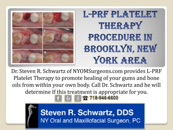 L-PRF Platelet Therapy Procedure in Brooklyn, New York area - NYOMSurgeons.com