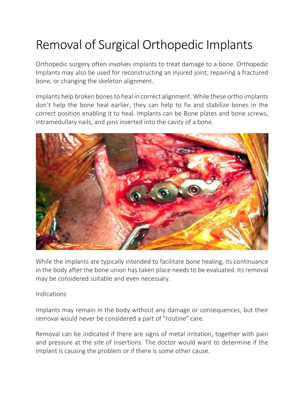 removal of surgical orthopedic implants
