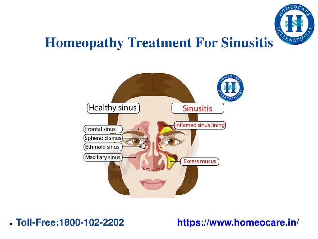 homeopathy treatment for sinusitis