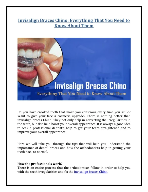 Invisalign Braces Chino: Everything That You Need to Know About Them