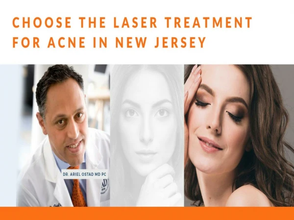 Choose the Laser Treatment for Acne in New Jersey