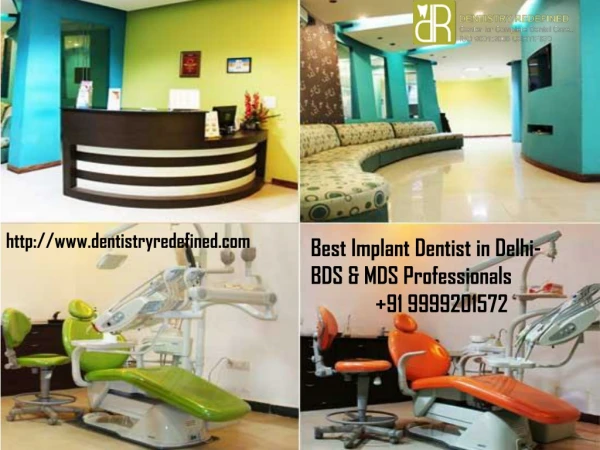 Best Implant Dentist in Delhi- BDS & MDS Professionals