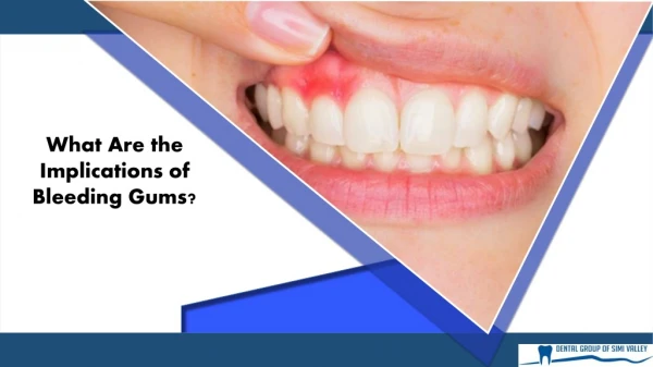 What are the Implications of Bleeding Gums