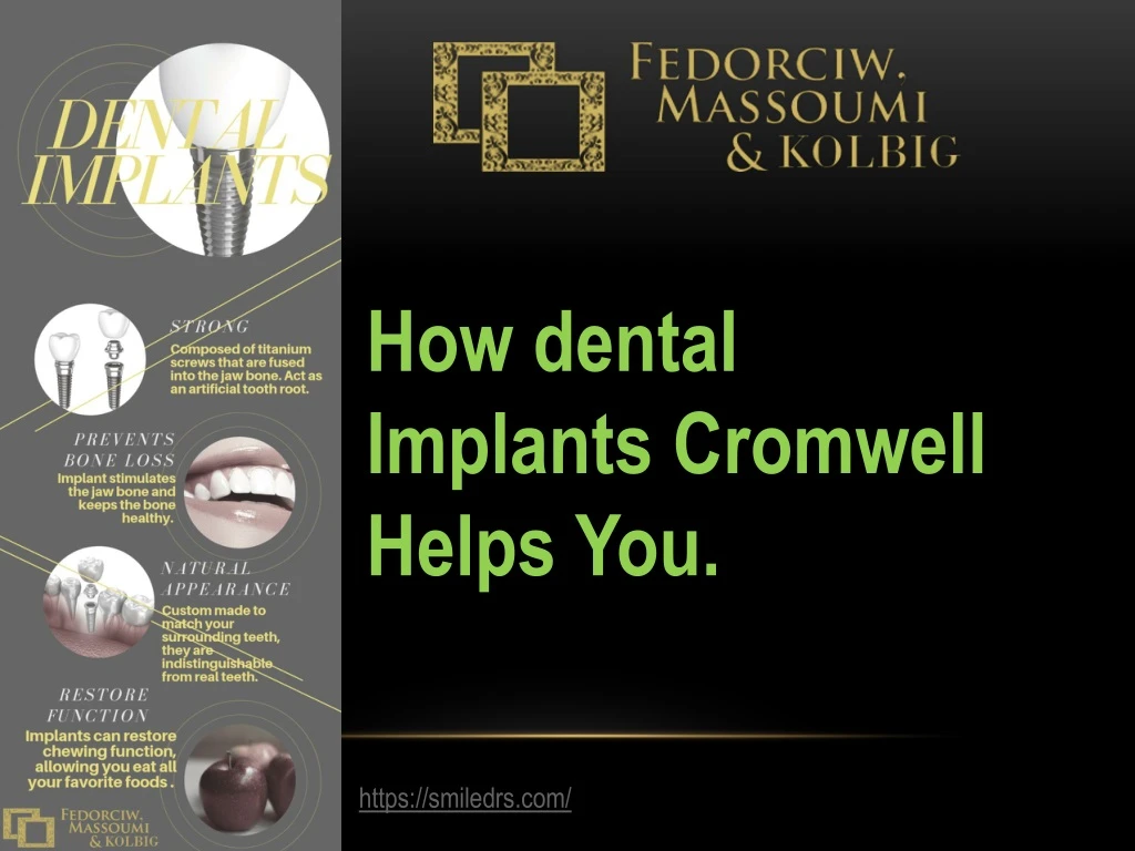 how dental implants cromwell helps you