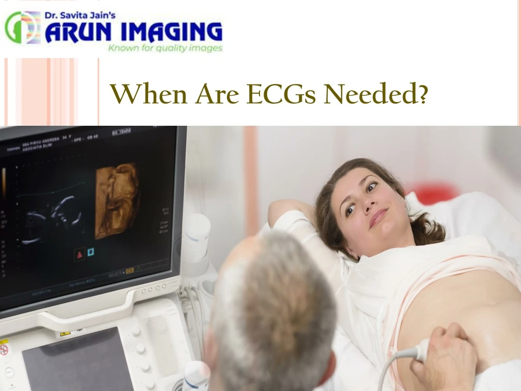 when are ecgs needed