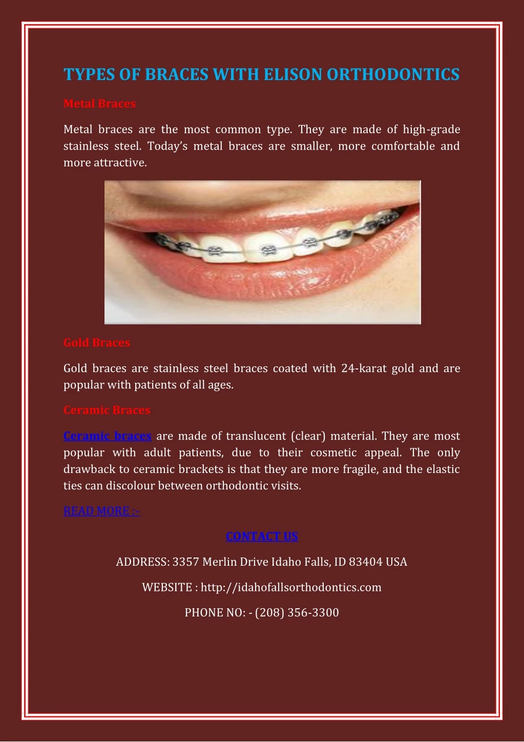 types of braces with elison orthodontics