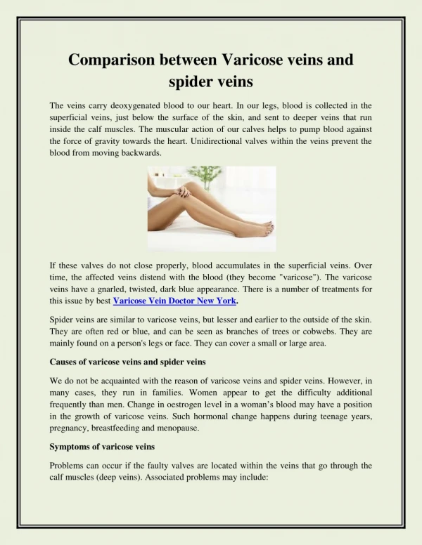 Comparison between Varicose veins and spider veins