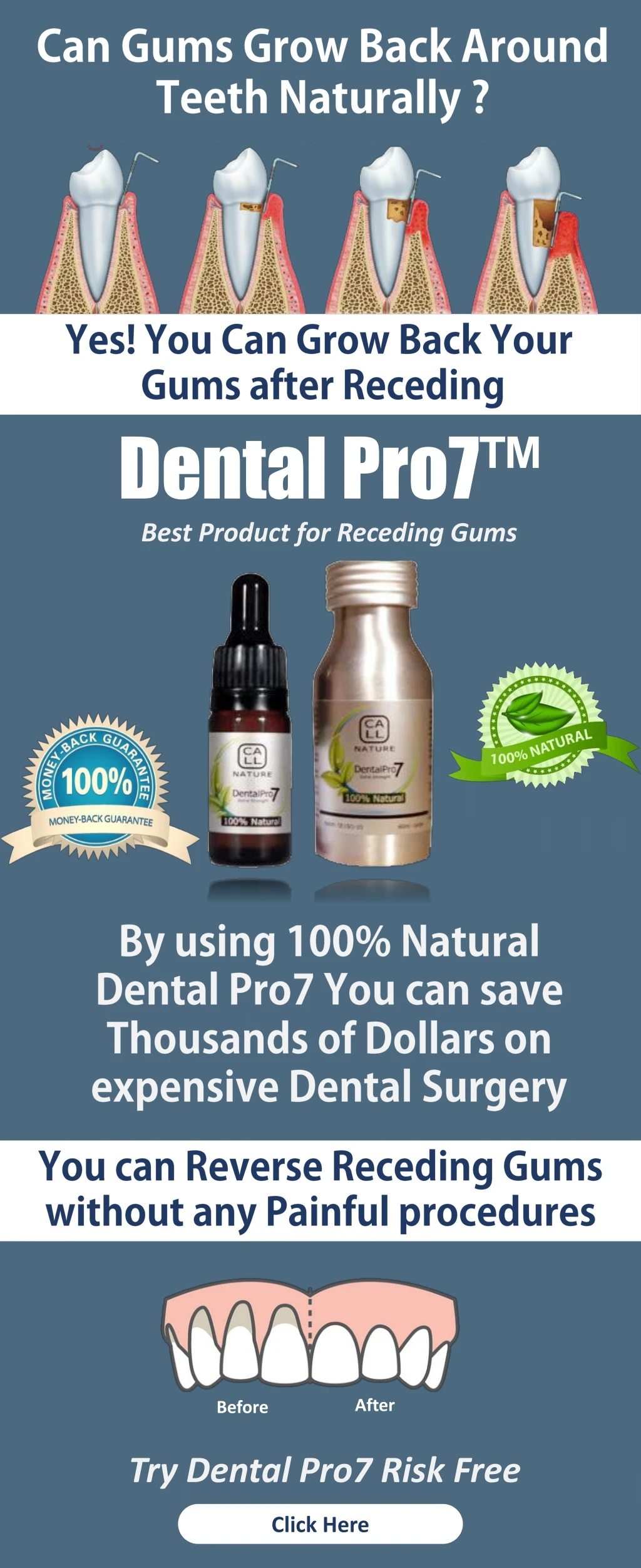 dental pro7 best product for receding gums